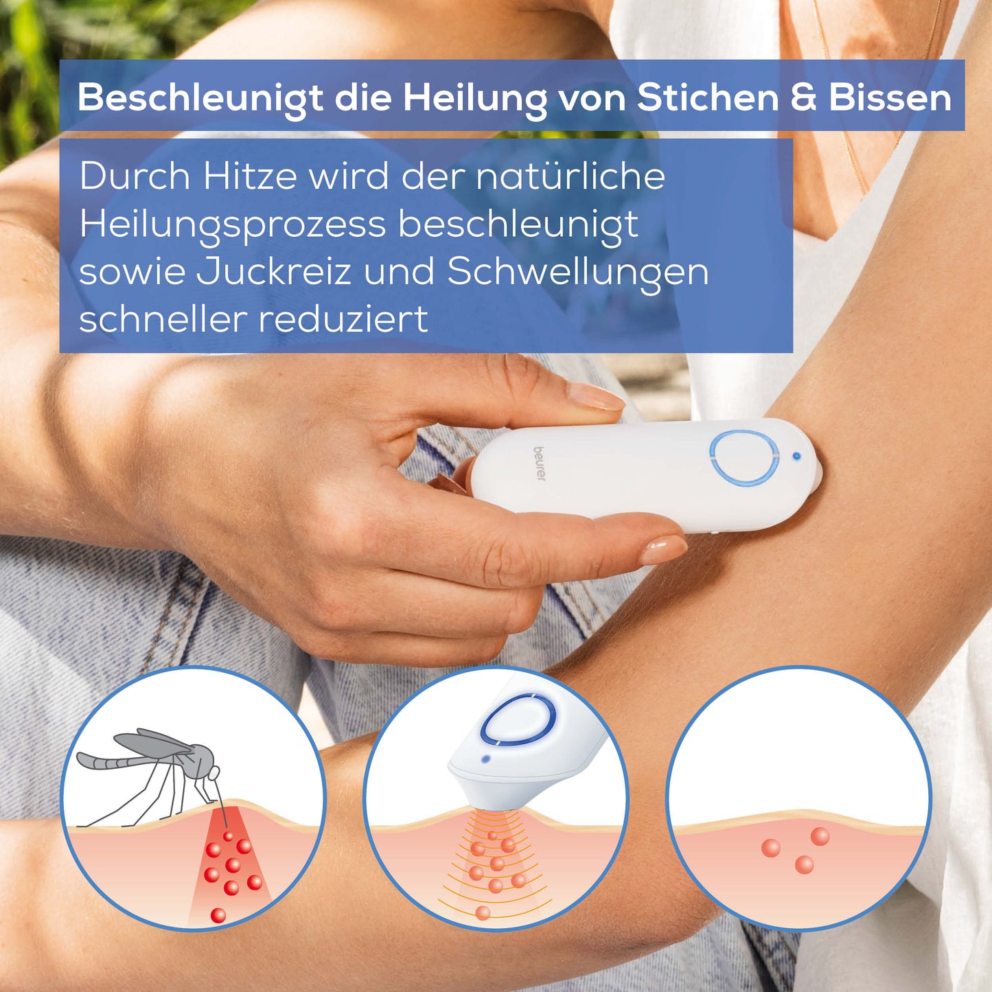 Beurer Insect bite healer BR 60